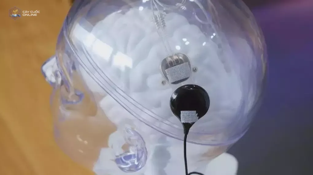 Hệ thống BCI Neo của Neuracle Medical Technology. Ảnh: Neuracle Medical Technology